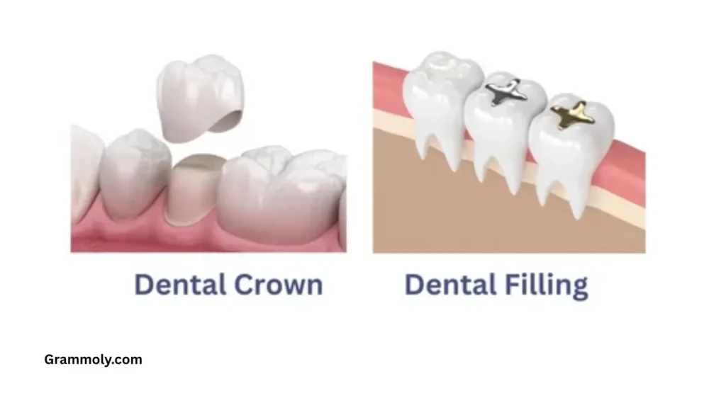 crown-vs-filling