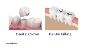 crown-vs-filling