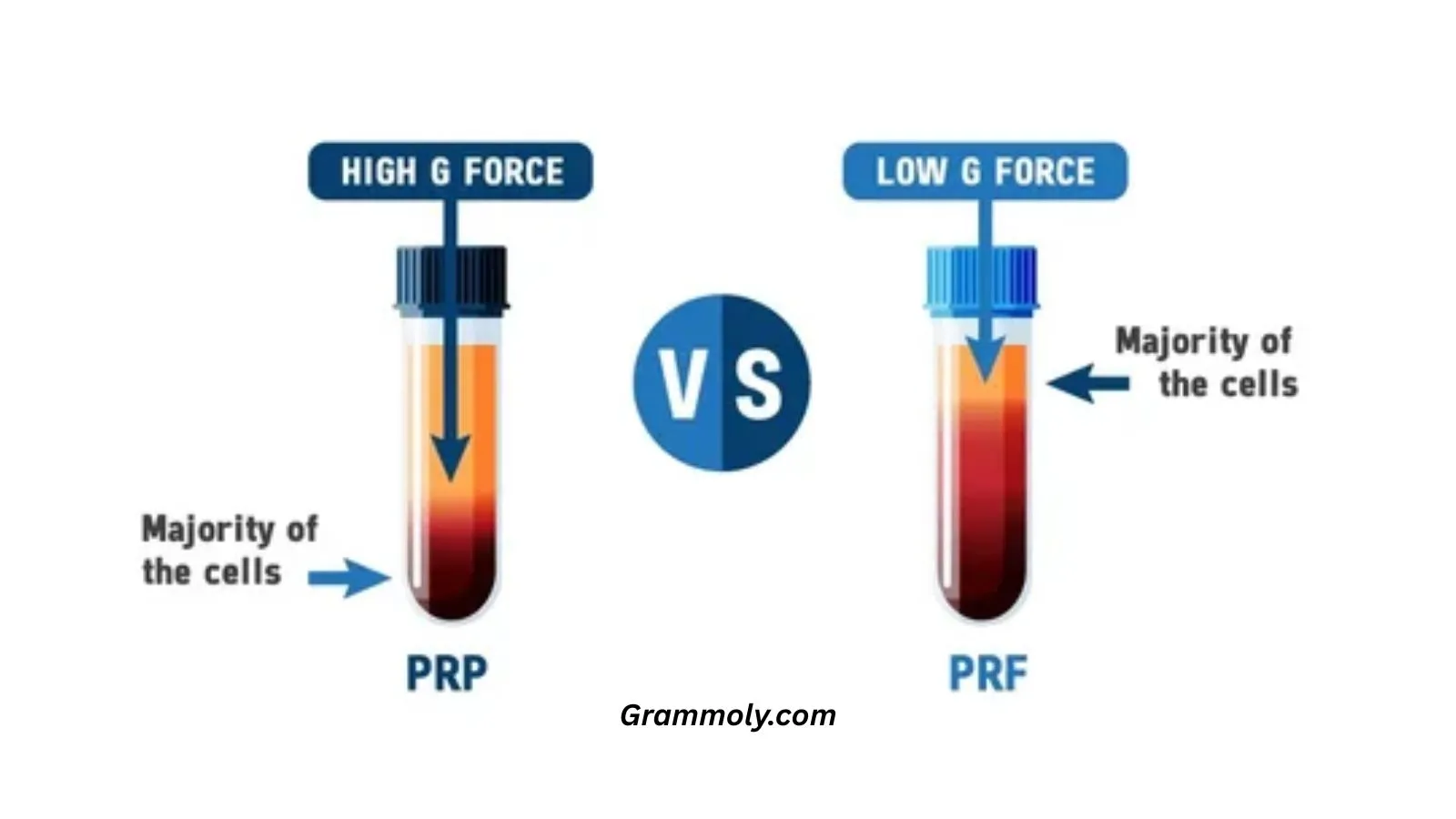 prp-or-prf