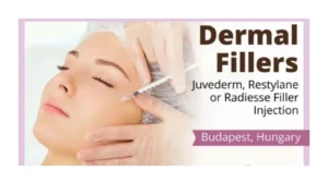 restylane-or-radiesse